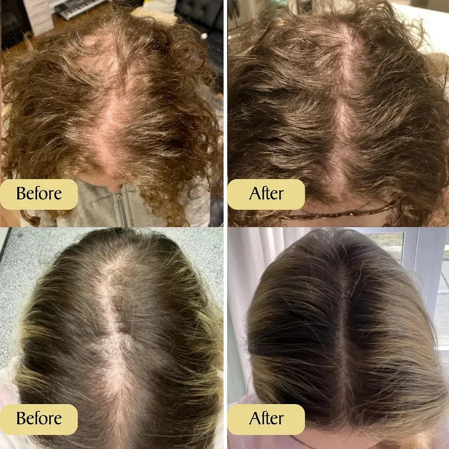 Deoxyribose Scalp Serum | Korean Hair Care, K-Beauty