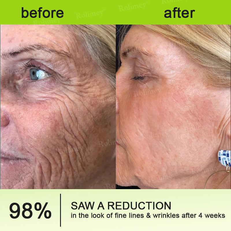 🔥 FLASH SALE 70% OFF | QIAWI™ Wrinkle Lift & Firming Cream