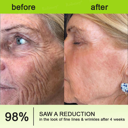 🔥 FLASH SALE 70% OFF | QIAWI™ Wrinkle Lift & Firming Cream
