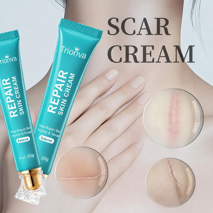 🧺 BUY 1 GET 1 FREE! 🧼Repair Scar Cream🥳