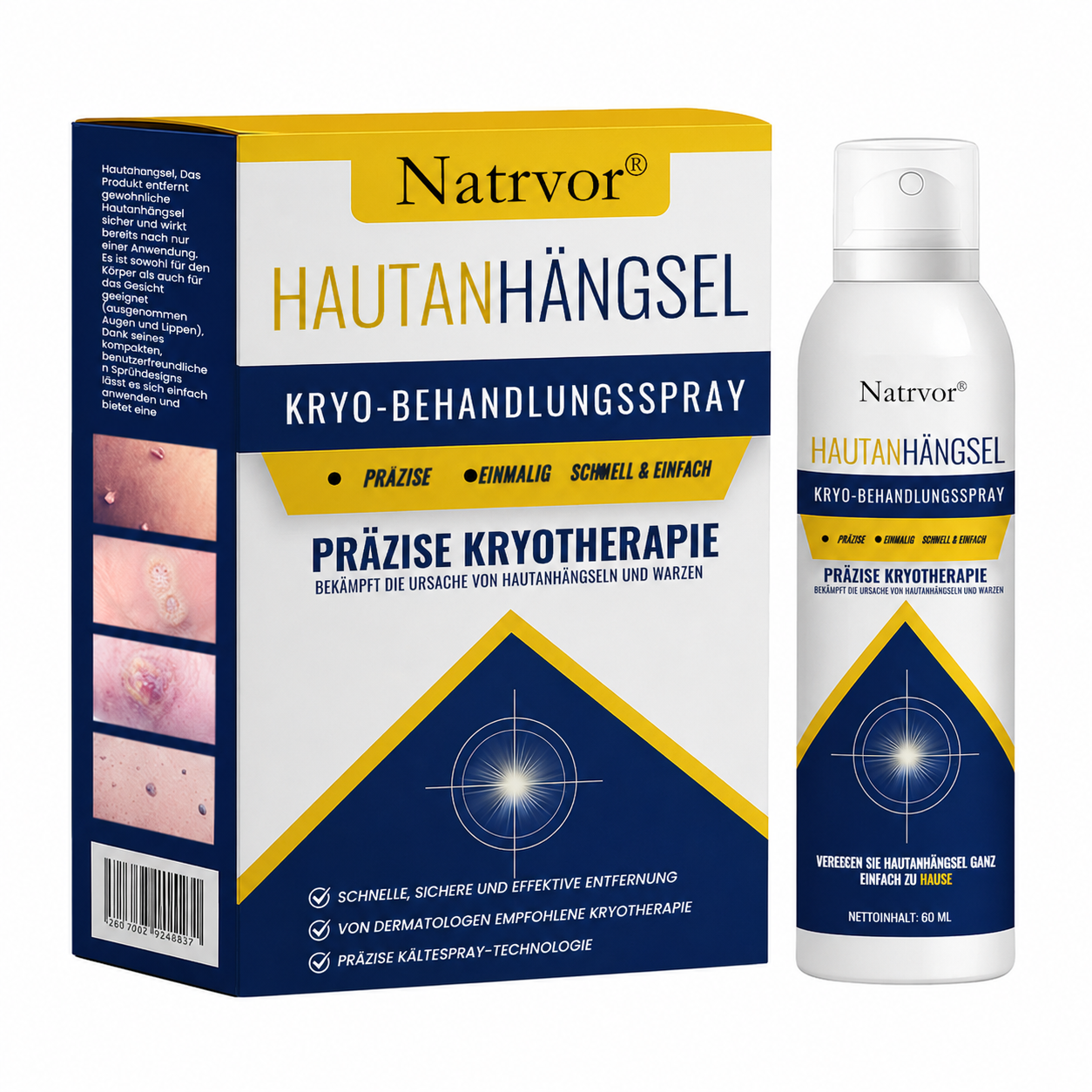 Natrvor® Hautanhängsel Kryo-Behandlungsspray Spray: Schnelle Entfernung von Warzen & Hornhaut – 7 Tage sichtbare Ergebnisse ✨
