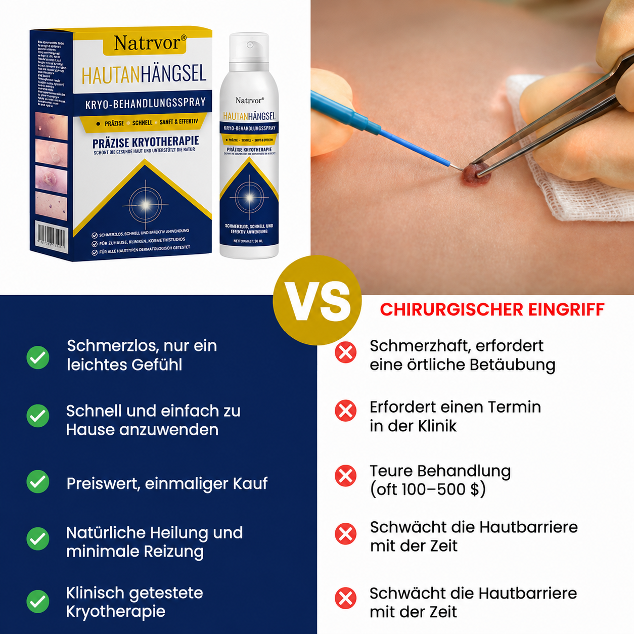 Natrvor® Hautanhängsel Kryo-Behandlungsspray Spray: Schnelle Entfernung von Warzen & Hornhaut – 7 Tage sichtbare Ergebnisse ✨