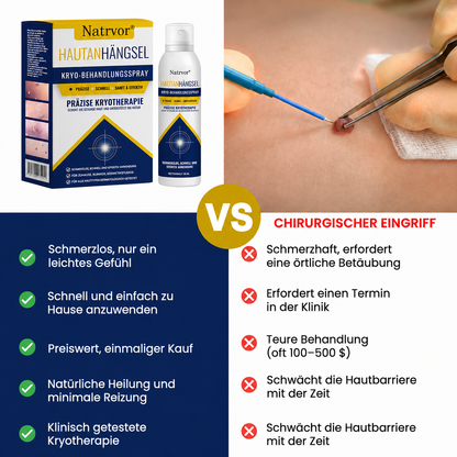 Natrvor® Hautanhängsel Kryo-Behandlungsspray Spray: Schnelle Entfernung von Warzen & Hornhaut – 7 Tage sichtbare Ergebnisse ✨
