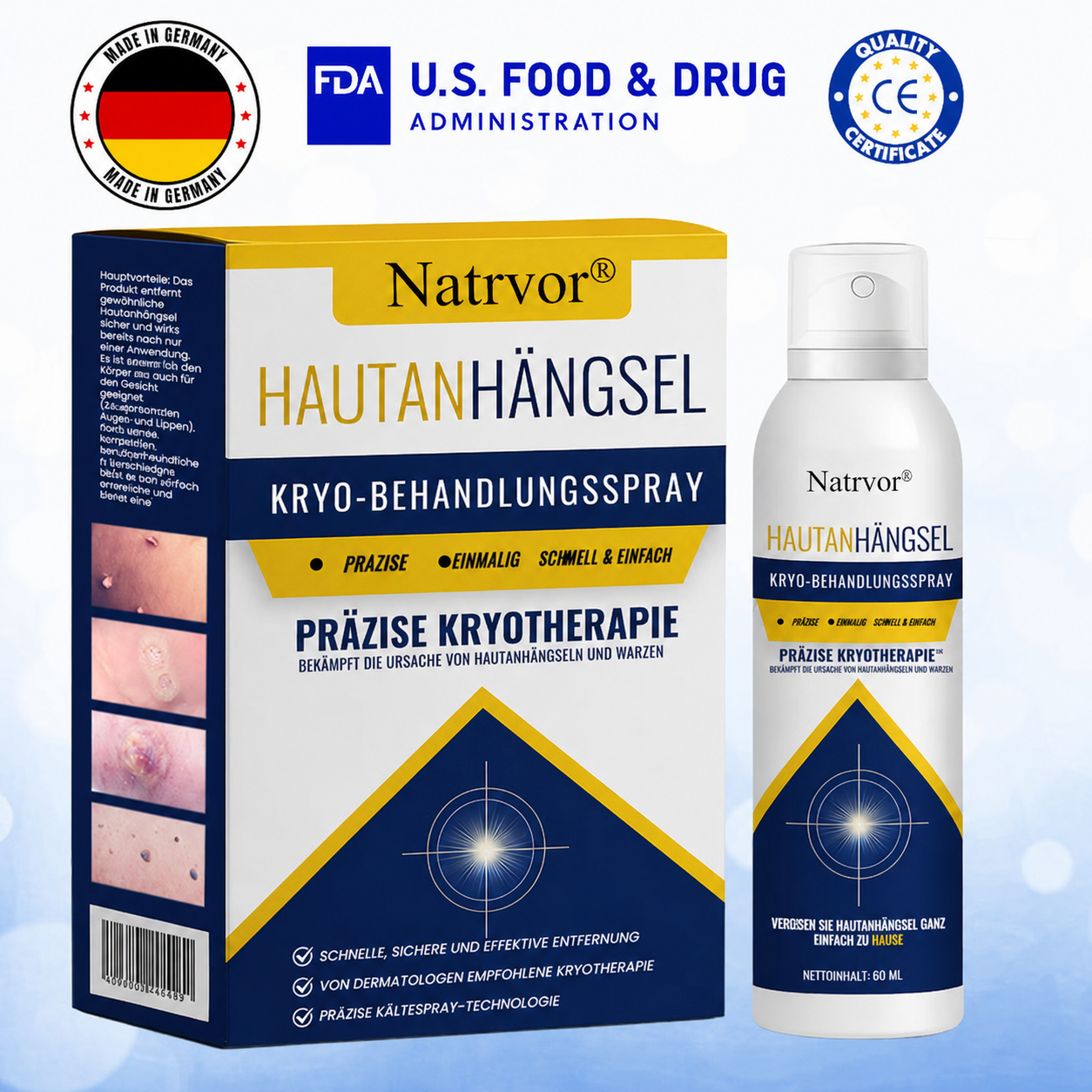 Natrvor® Hautanhängsel Kryo-Behandlungsspray Spray: Schnelle Entfernung von Warzen & Hornhaut – 7 Tage sichtbare Ergebnisse ✨
