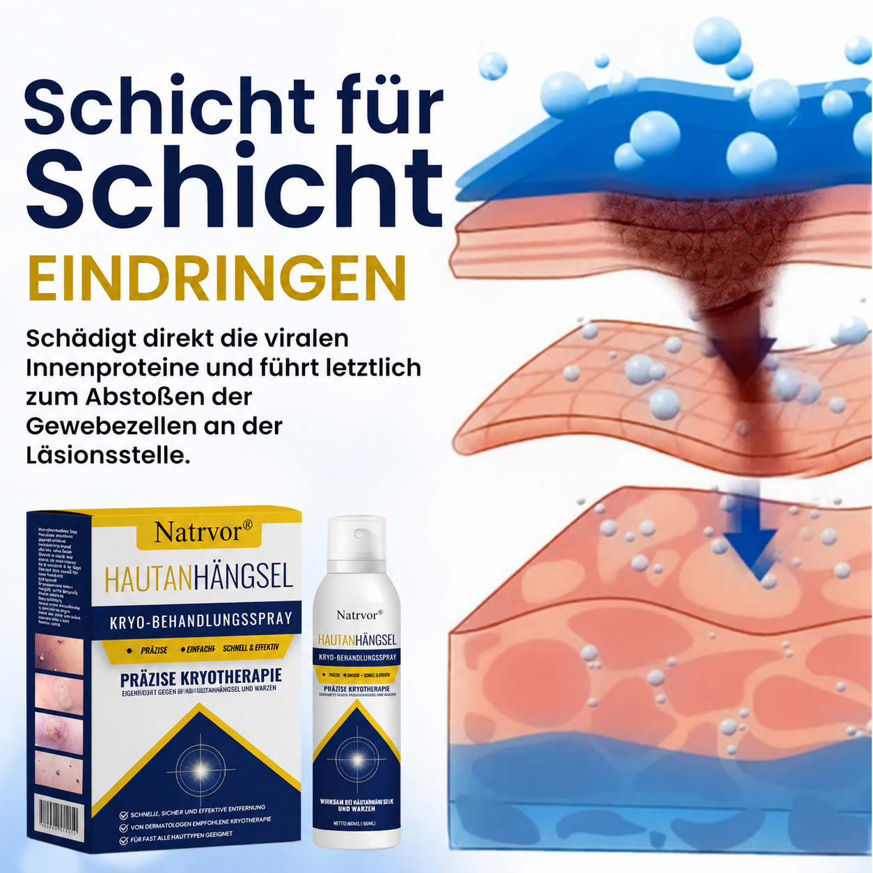 Natrvor® Hautanhängsel Kryo-Behandlungsspray Spray: Schnelle Entfernung von Warzen & Hornhaut – 7 Tage sichtbare Ergebnisse ✨