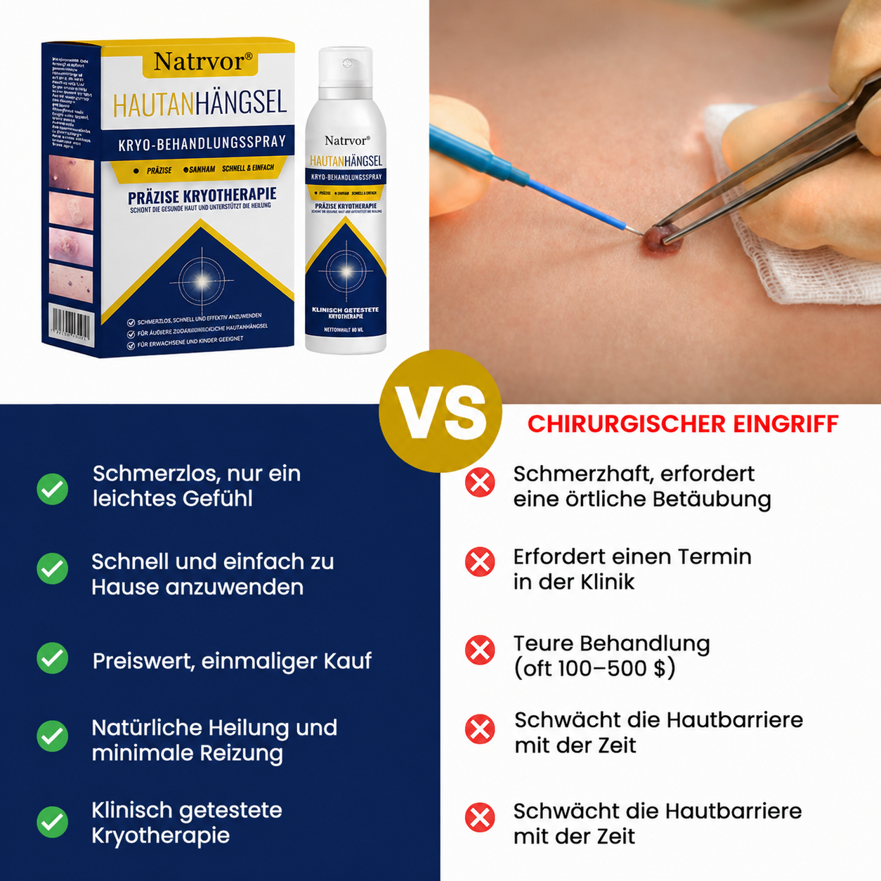 Natrvor® Hautanhängsel Kryo-Behandlungsspray Spray: Schnelle Entfernung von Warzen & Hornhaut – 7 Tage sichtbare Ergebnisse ✨