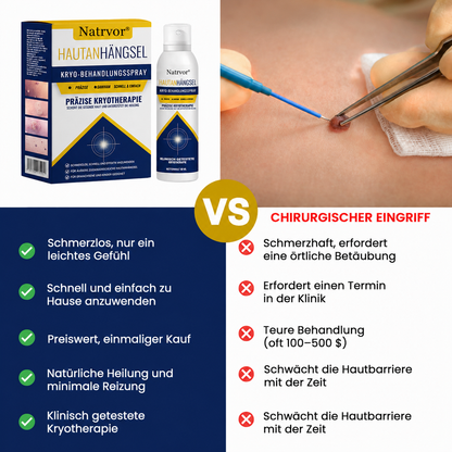 Natrvor® Hautanhängsel Kryo-Behandlungsspray Spray: Schnelle Entfernung von Warzen & Hornhaut – 7 Tage sichtbare Ergebnisse ✨