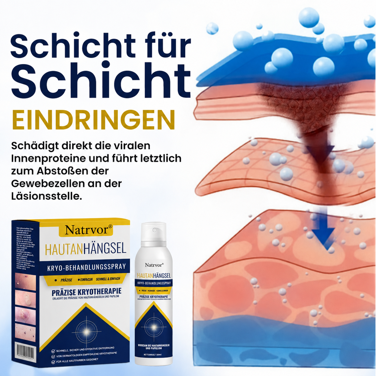 Natrvor® Hautanhängsel Kryo-Behandlungsspray Spray: Schnelle Entfernung von Warzen & Hornhaut – 7 Tage sichtbare Ergebnisse ✨