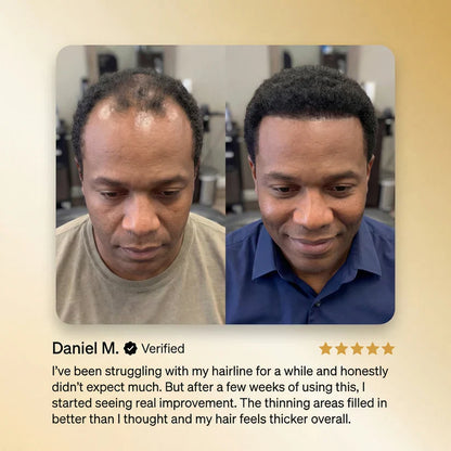 Ultimate Hair Regrowth Therapy Targets Hair Loss, Premature Gray Hair, Dry Frizz, and Hair Damage -III
