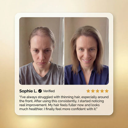 Ultimate Hair Regrowth Therapy Targets Hair Loss, Premature Gray Hair, Dry Frizz, and Hair Damage -III