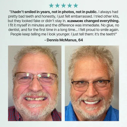 🏆Flash Sale 5K+ SOLD!✨Realistic Upper & Lower Dentures - Natural-Looking Teeth Replacement
