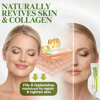 🔥 FLASH SALE 70% OFF | Wrinkle Lift & Firming Cream