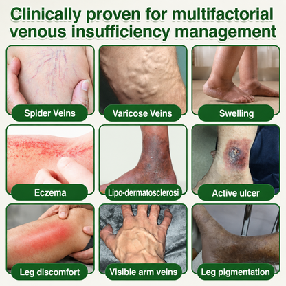 🇺🇸🏆Flash Sale 5K+ SOLD!✨7-in-1 Microneedle Vein & Lipedema Treatment Patch