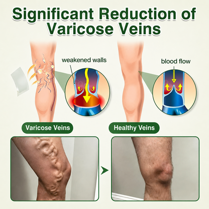🇺🇸🏆Flash Sale 5K+ SOLD!✨7-in-1 Microneedle Vein & Lipedema Treatment Patch