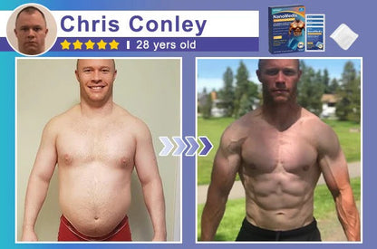 🔥Limited-time 50% sale🔥⚕️💙Slimoly® Gynecomastia Chest Fatburn & Firm Patch
